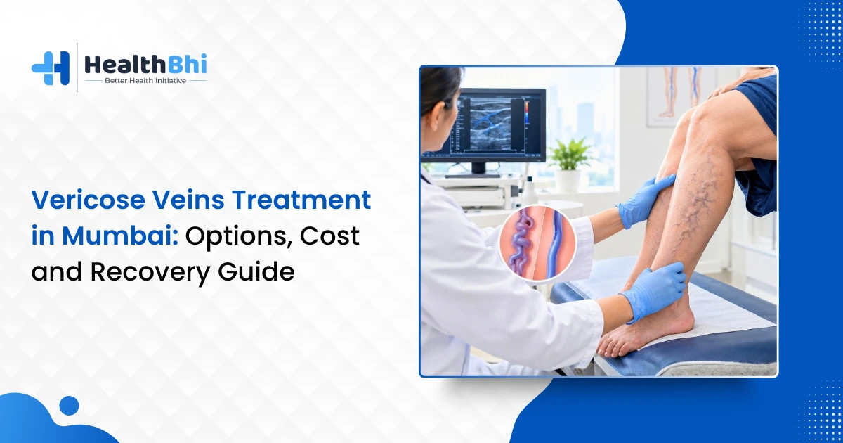 Vericose Veins Treatment in Mumbai: Options, Cost and Recovery Guide